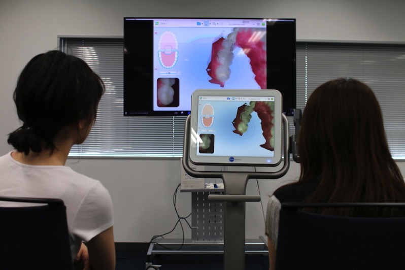 インビザライン用口腔内スキャン装置iTeroのトレーニング・デイ