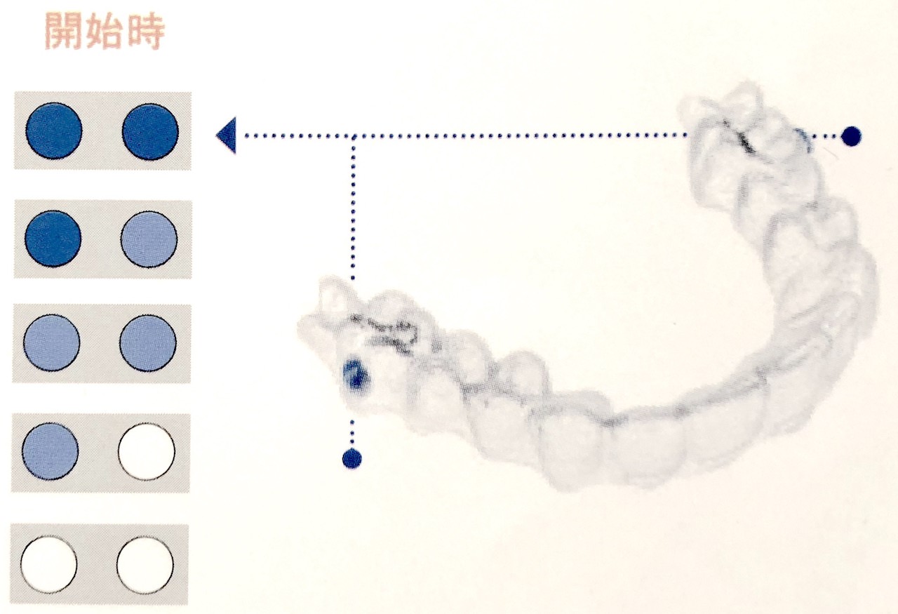 コンプライアンス・インジケーター