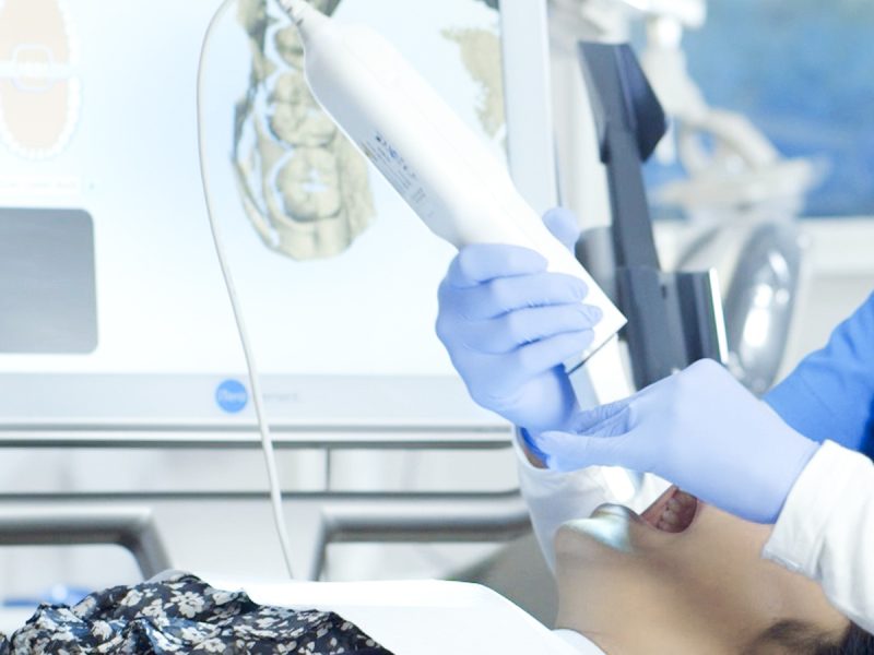 インビザライン料金プランの実際（一般歯科に多い「インビザラインGO」は「インビザライン」のライトバージョン）