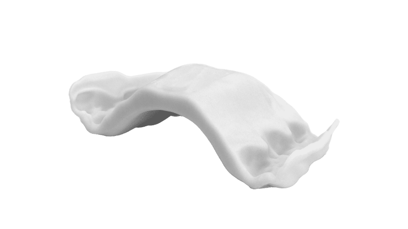 新発売の【インビザライン口蓋拡大システム】効果と価格を徹底解説！