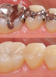 何度も治療を繰り返すこと