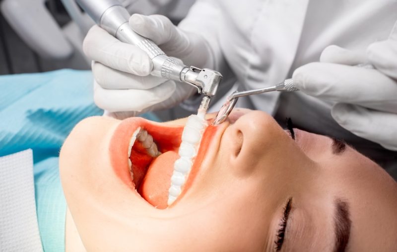 予防歯科・歯周病治療