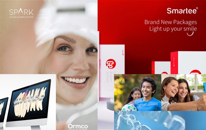 矯正方法の選びかた